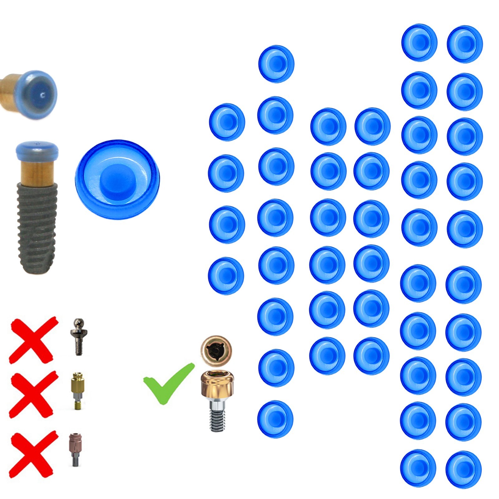 US Implant Replace Standard Male Inserts Fit ZEST Locator Legacy Dental Abutment