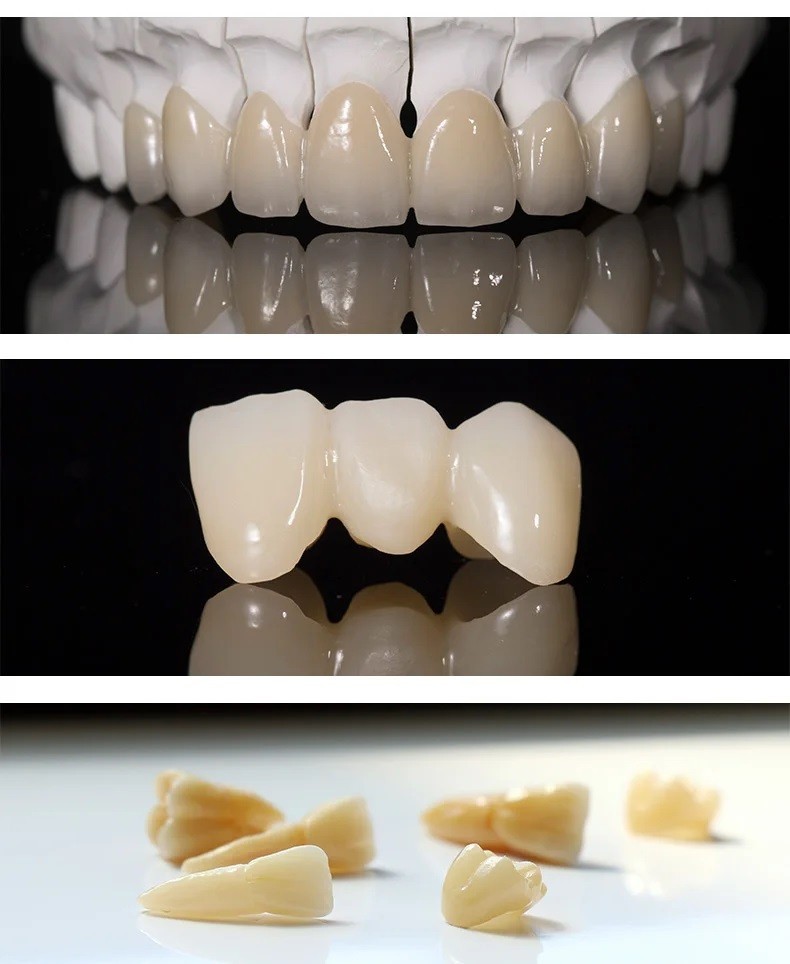 C14 Emax Lithium Disilicate Block Chairside CAD/CAM CEREC Same-Day Crown Veneer