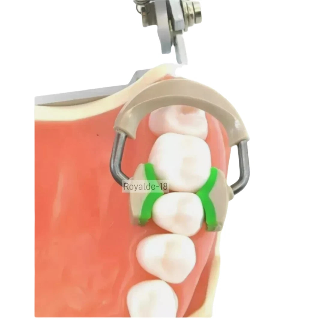 Dental Sectional Matrix System Nickel Titanium Alloy Matrices Clip Ring Bands