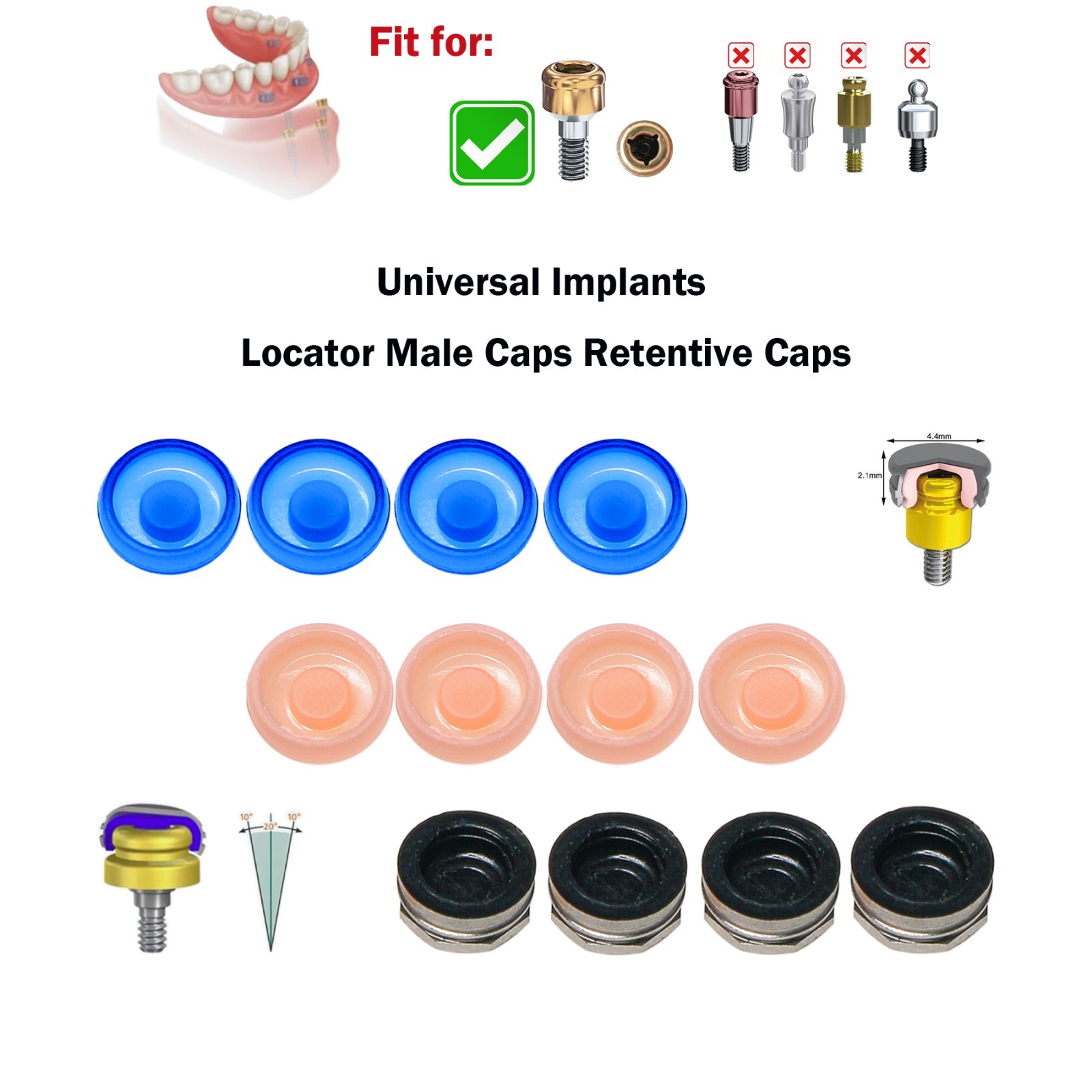 Dental Overdenture Implant Locator Abutment Retention Caps Male Cap Inserts Set