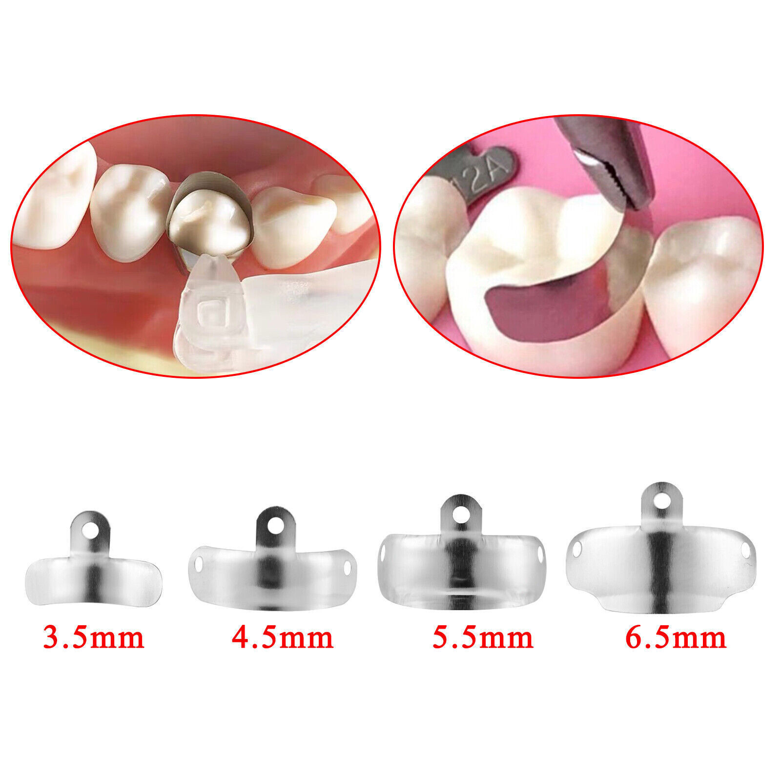 Dental Metal Matrices Sectional Molar Matrix Refill Soft Band (Choose Size/Qty)