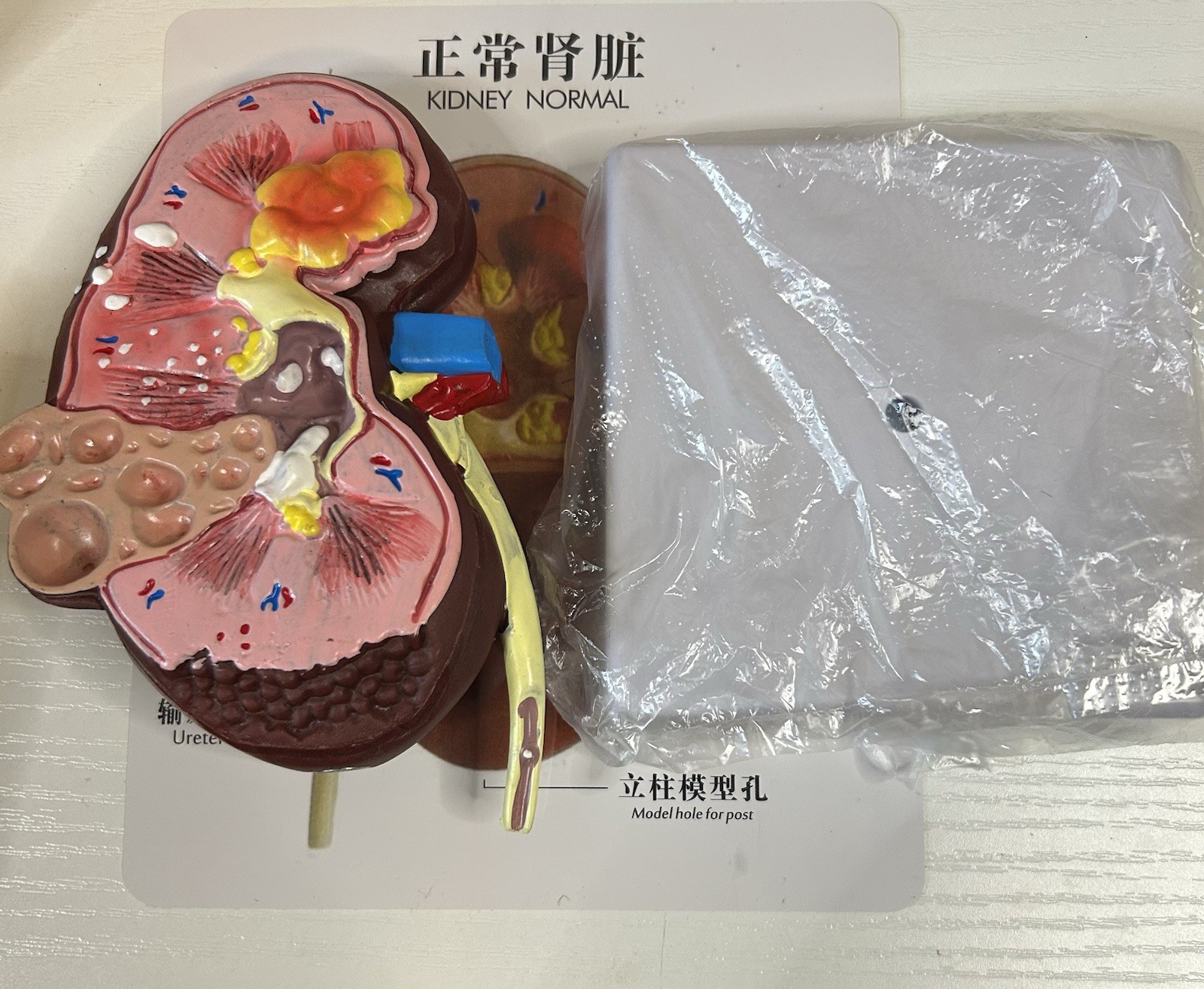 NEW Human Normal/Pathological Kidney Model Anatomy Medical Teaching Model