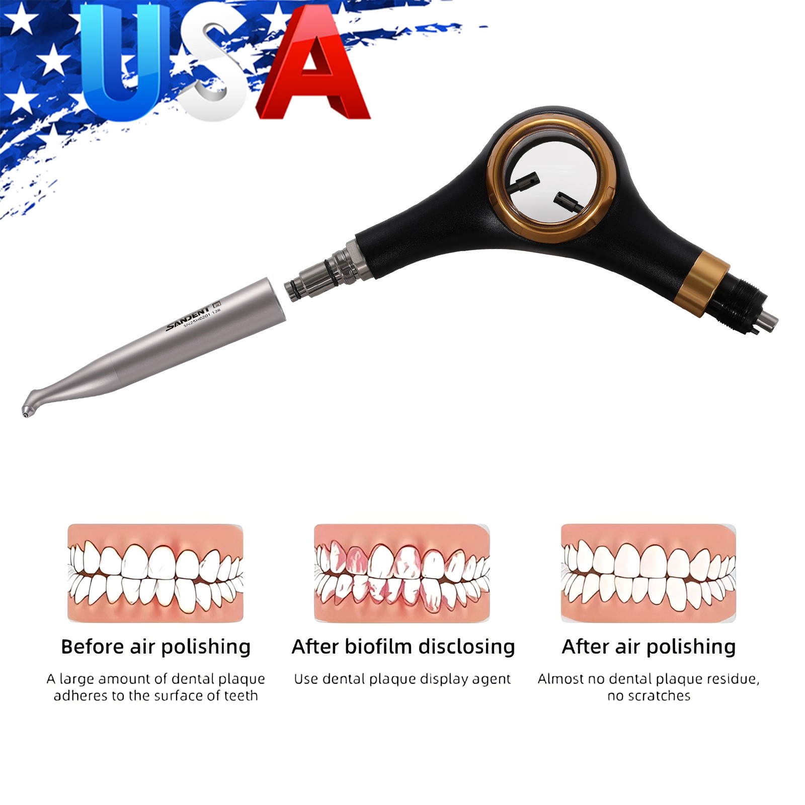 Woodpecker Style Dental Air Polisher AP-H Supragingival Polishing Handpiece