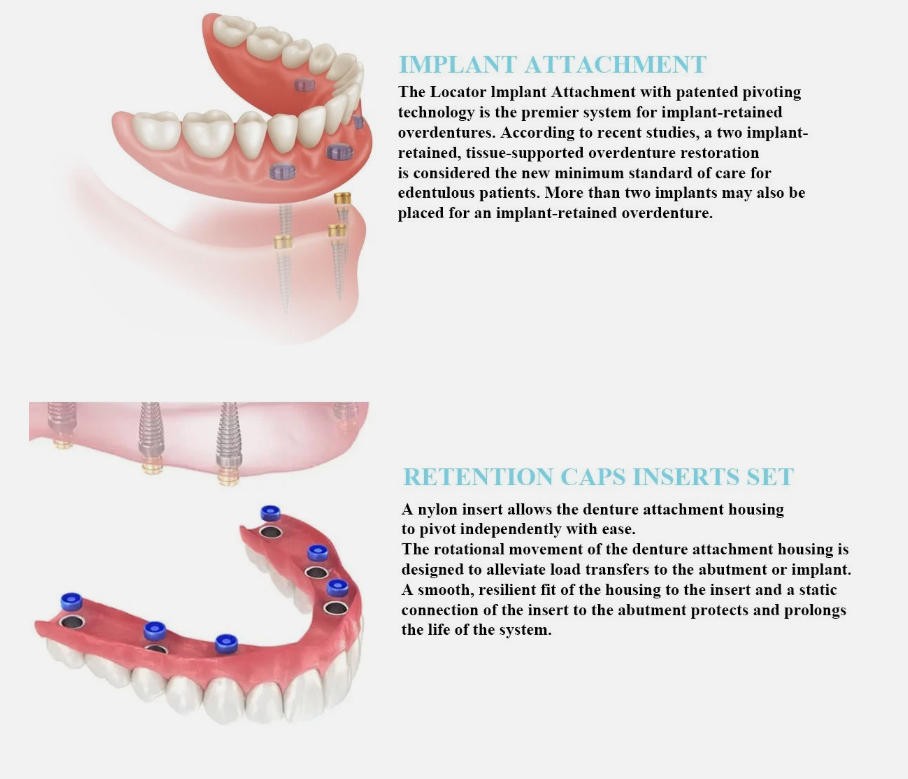 ZEST NOBEL Locator Abutment for Nobel Biocare Active Conical Connection NP & RP