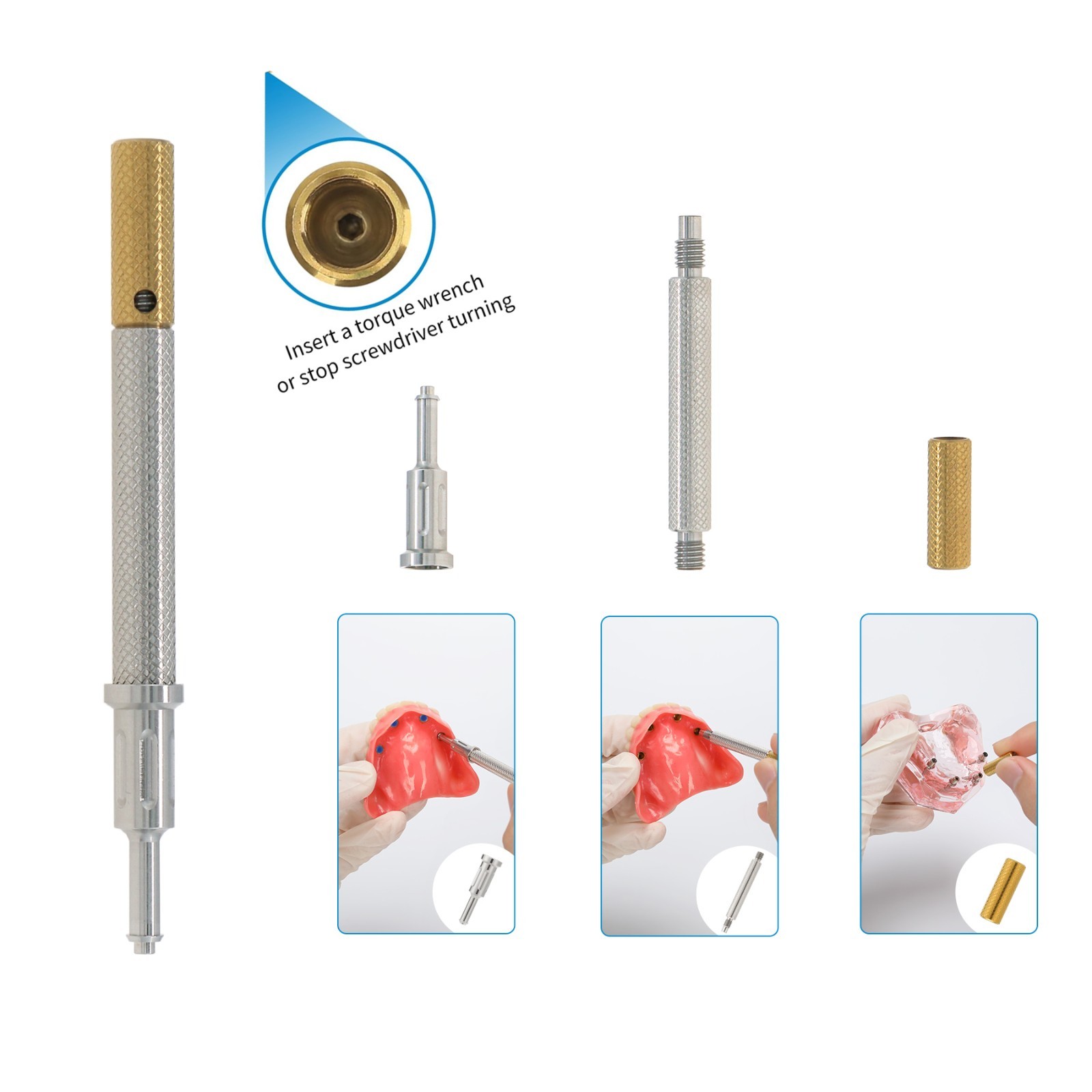Locator Abutment for Hiossen ET DIO UF/Snucone Regular Overdenture Retention Cap