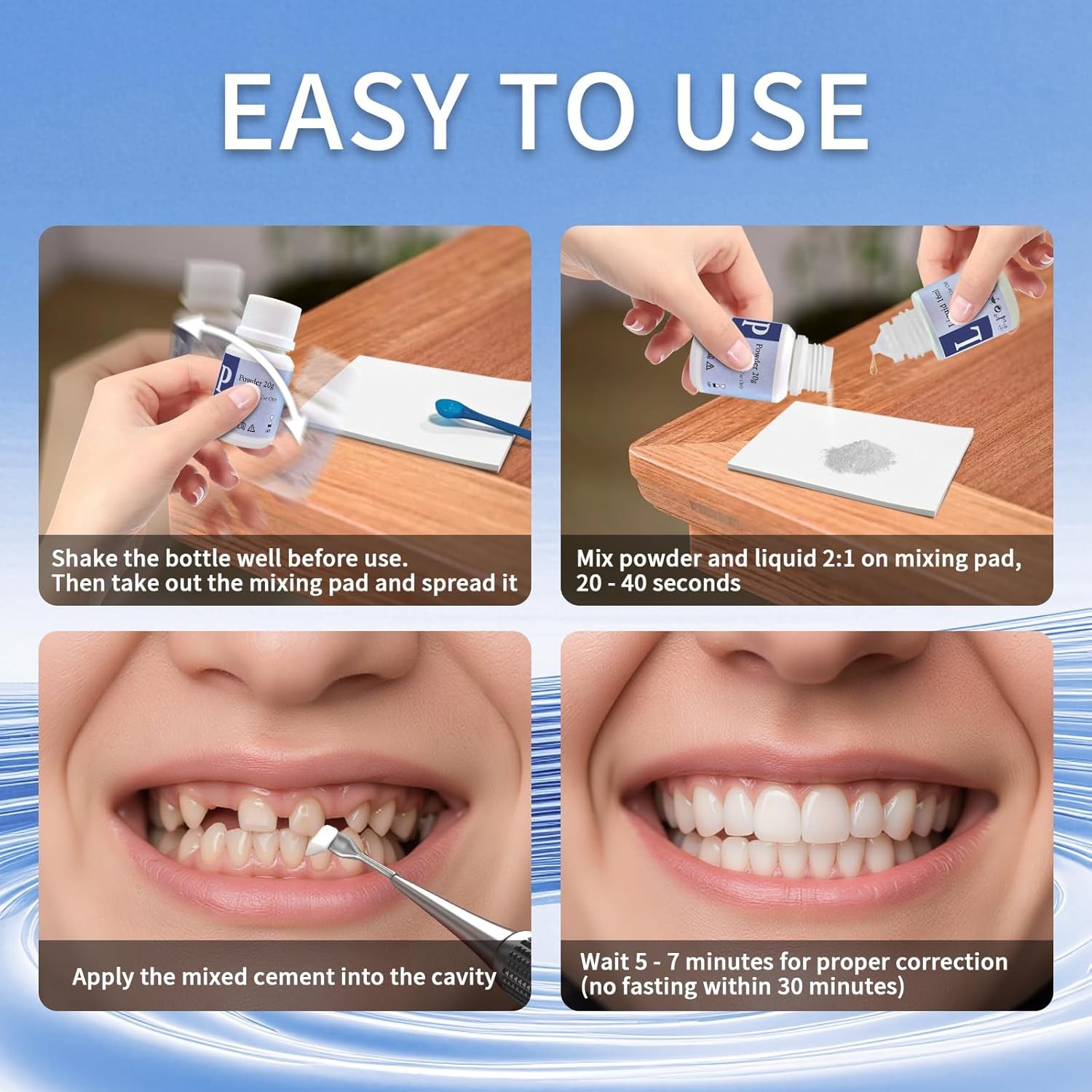 Zinc Oxide Eugenol Dental Cement Kit for Temporary Tooth Replacement