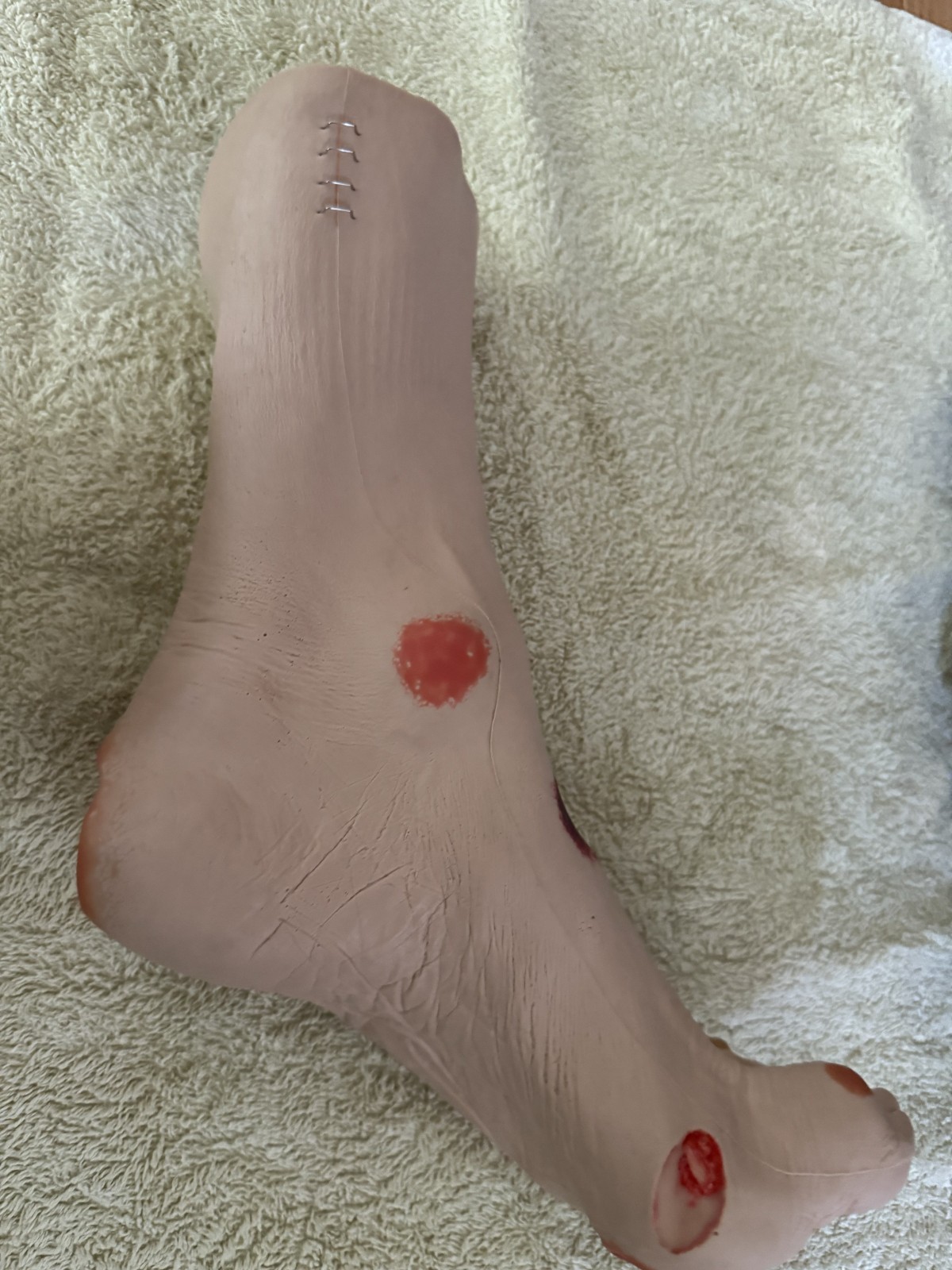 VATA Wilma Wound Foot Teaching Model
