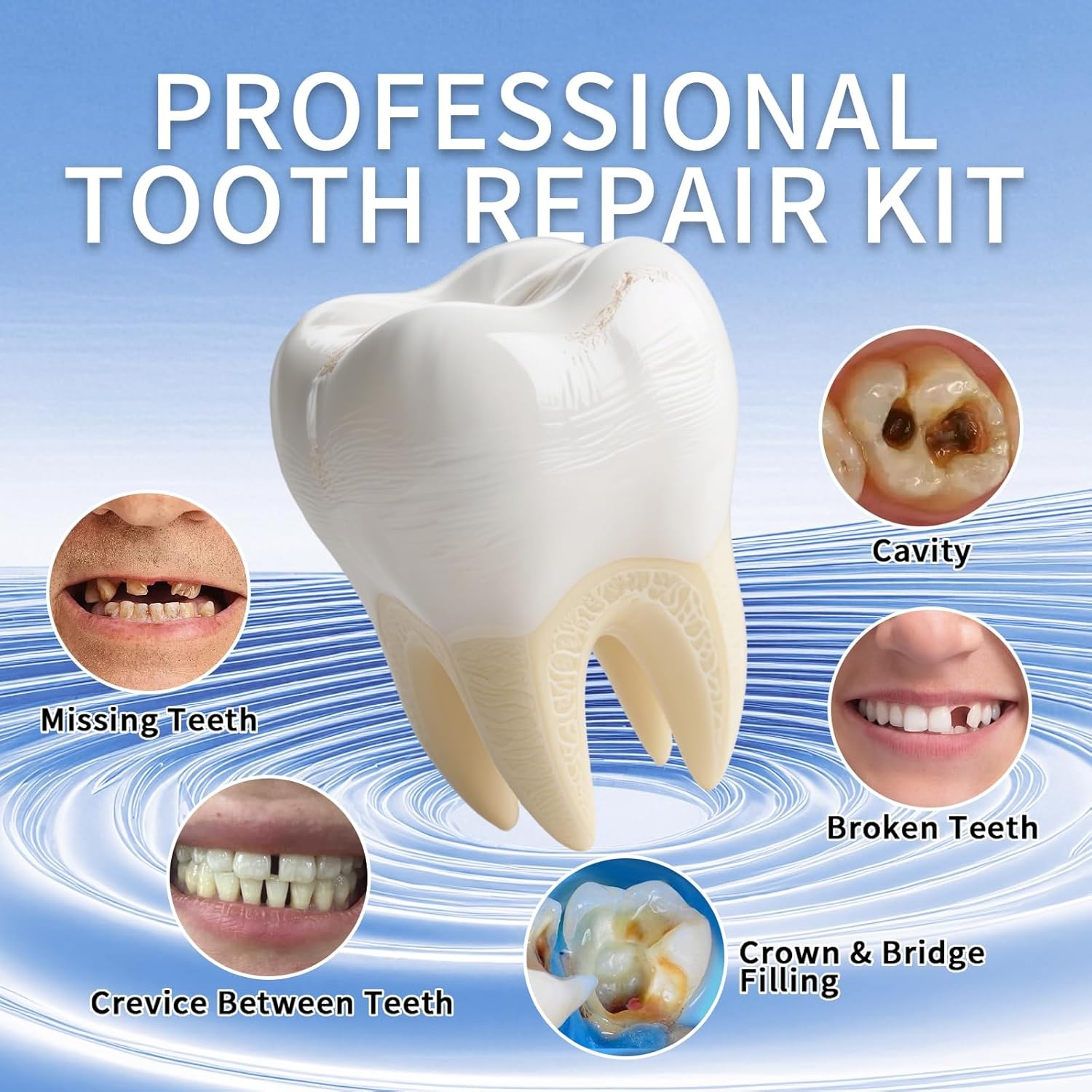 Zinc Oxide Eugenol Dental Cement Kit for Temporary Tooth Replacement