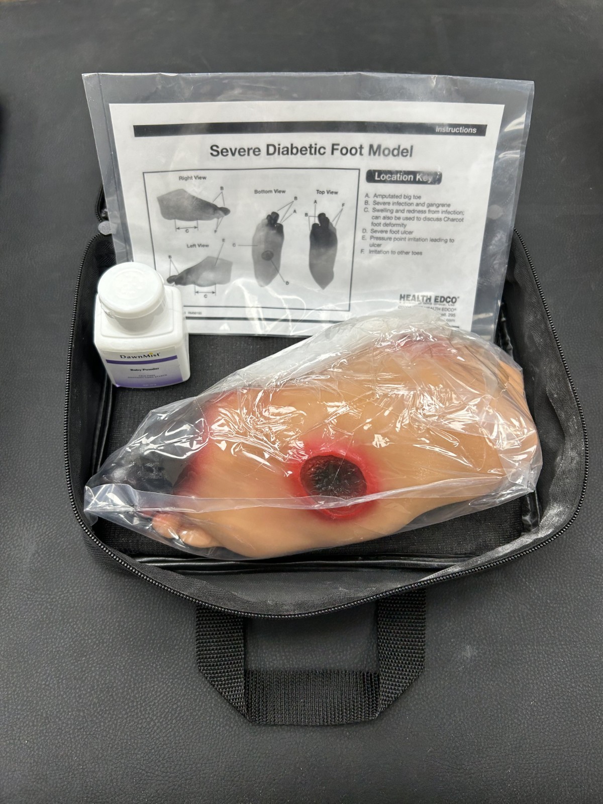 Diabetic Foot Model Set (Severe)