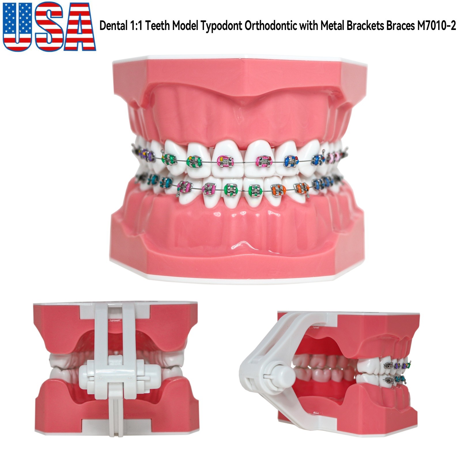 US Dental Orthodontic Typodont 1:1 Teeth Model with Brackets Braces M7010-2 New