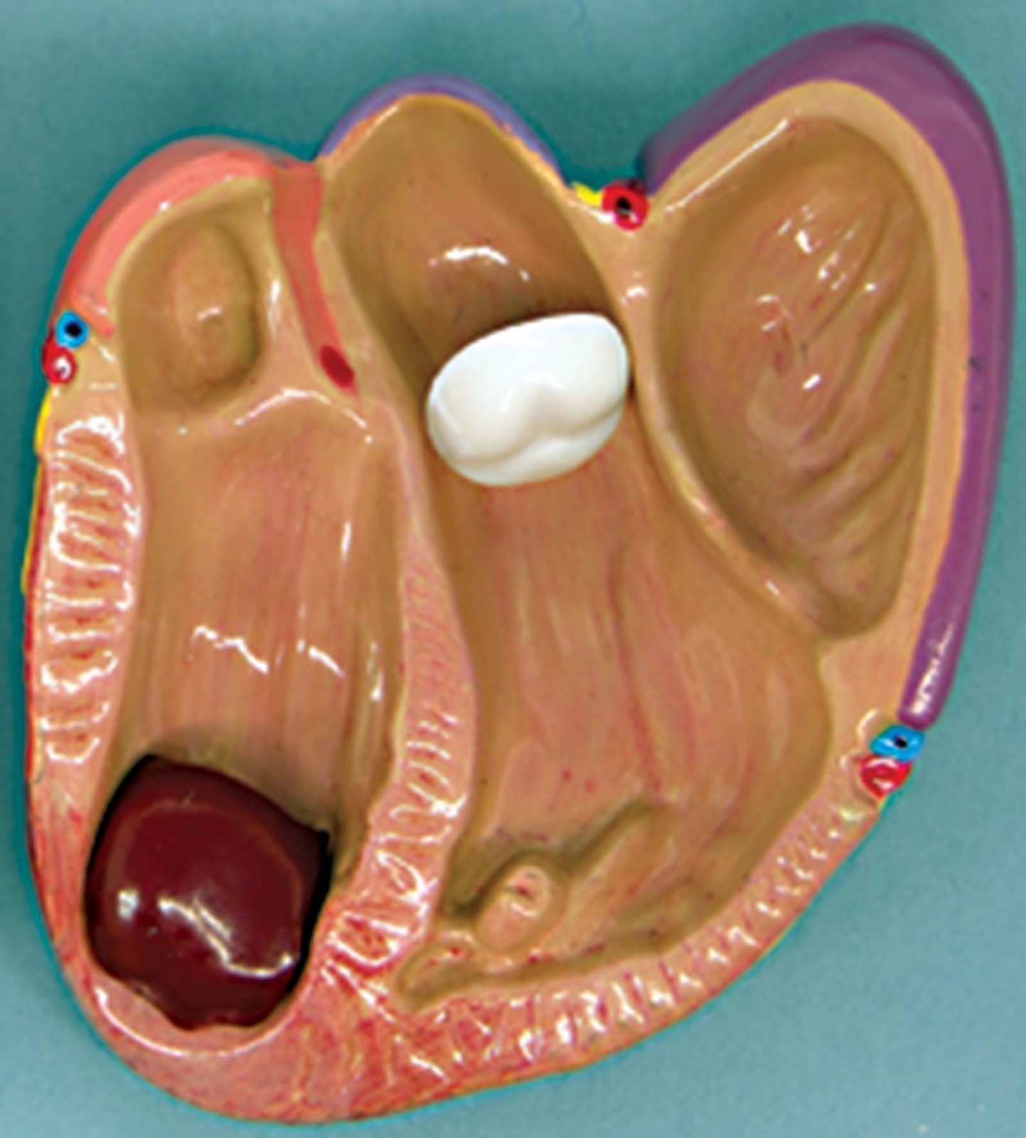 Mini Heart Set of 3 GPI Anatomical Models LFA#2550. Make Us an Offer . See VIDEO
