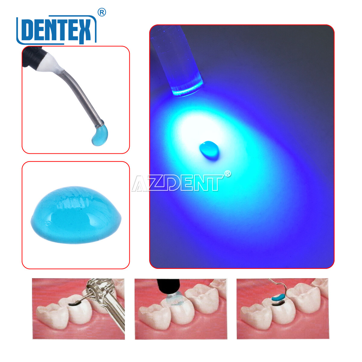 20pack Dentex DX.TEMP Dental Composite Resin 2.5g Temporary Flow Light Cure Blue