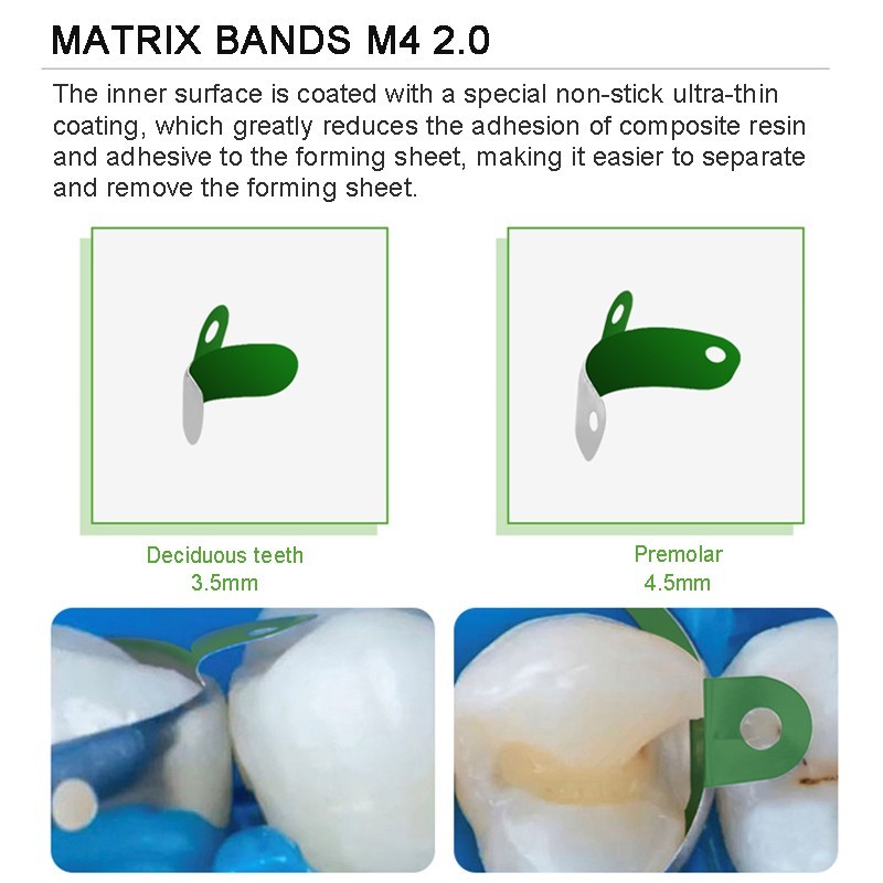 Dental Matrix Bands Ring Sectional Matrice Clamp Fit Garrison Palodent V3 System
