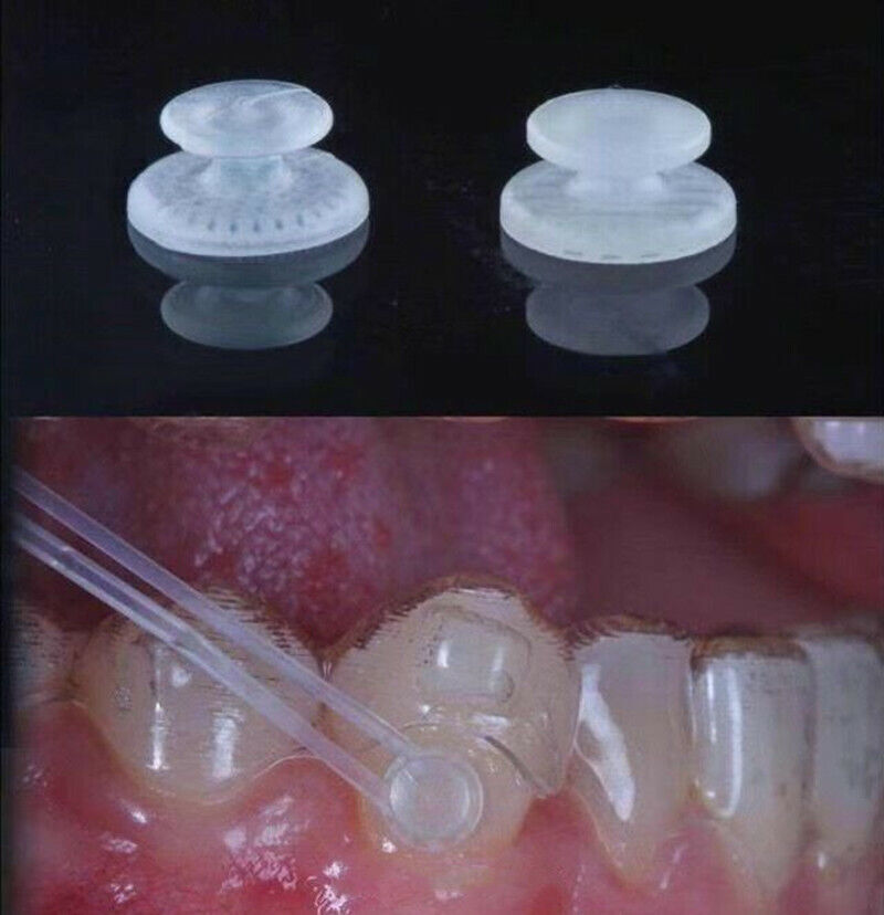 10-100Pcs Dental Lingual Button Ceramic Buttons Clear Invisable Retainer Aligner