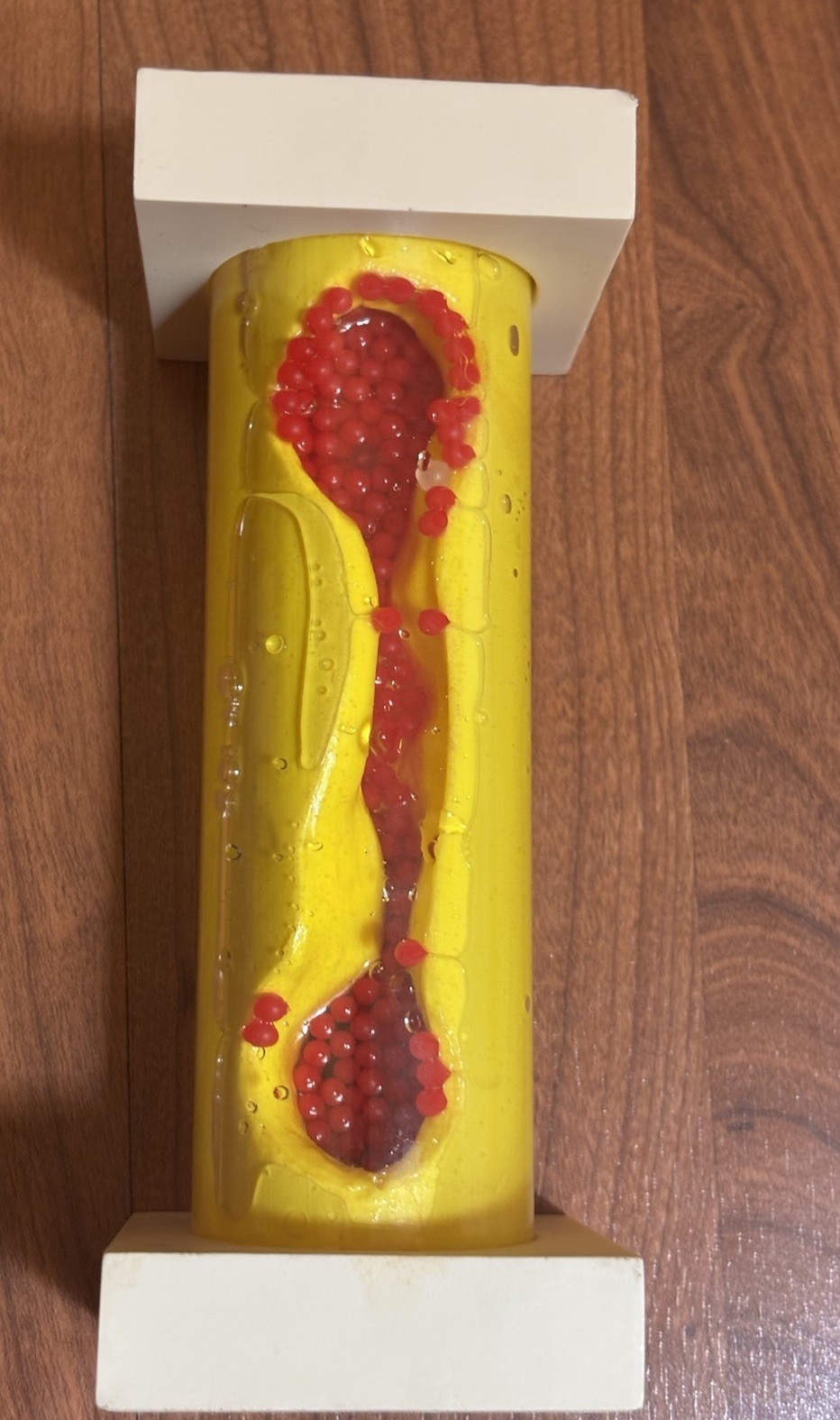 Health EDCO Occluded Artery Model Great Patient Visual Cholesterol Education