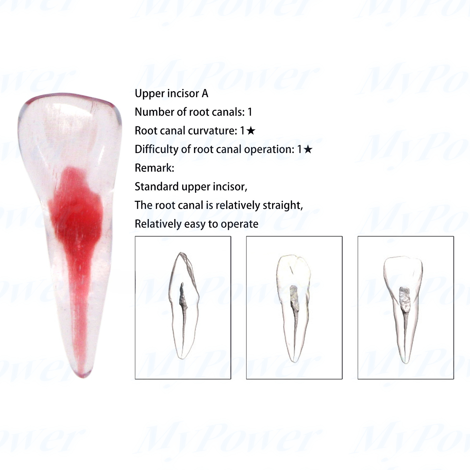 Dental Training 3D RCT Endo Tooth Model Practice Model Curved Root Resin Teeth