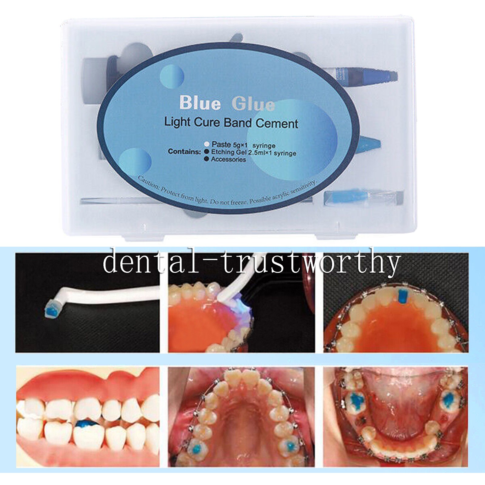 Dental Brackets /Orthodontic Light Cure Adhesive Kit/Blue Green Glue/Mini No-Mix