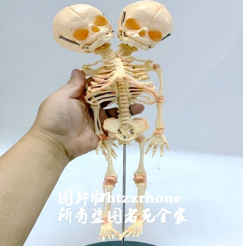 14″ Two-headed Baby Skeleton Model Fetal Model Teaching Newborn Skull Display