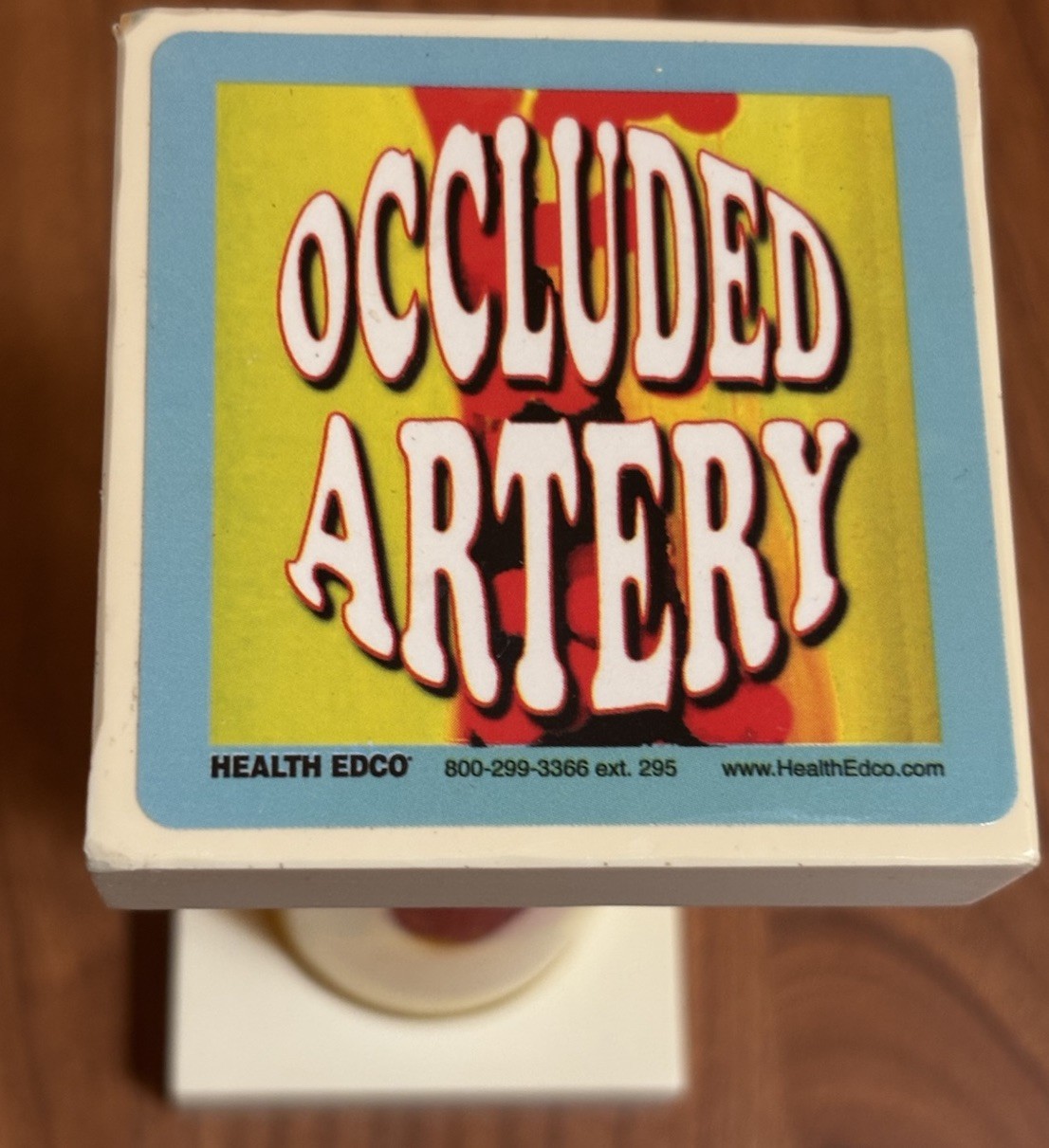 Health EDCO Occluded Artery Model Great Patient Visual Cholesterol Education