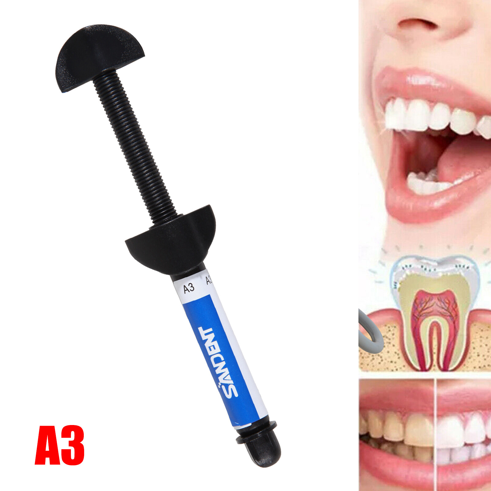 Dent Light Cure Hybrid Composite Dental Resin Shade A3 – 4.5 g syringe 001-001