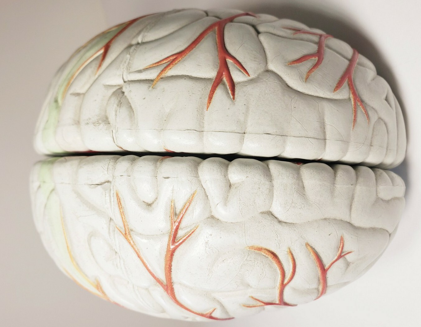 Human Brain Anatomical Teaching Model Life Size Medical Science Cross 4 Sections