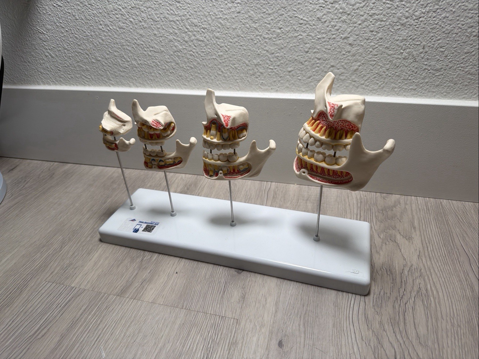 3B Scientific Dentition Development Model – 4 Stages Dental Teeth education
