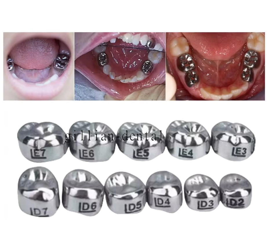 48Size Dental Kids Crown Stainless Steel Primary Molar Crowns Metal Pediatric