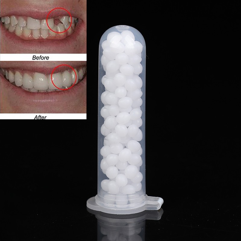 Temporary Tooth Repair Kit Teeth And Gaps False Teeth Solid Glue Dentu PfA7Uyt1
