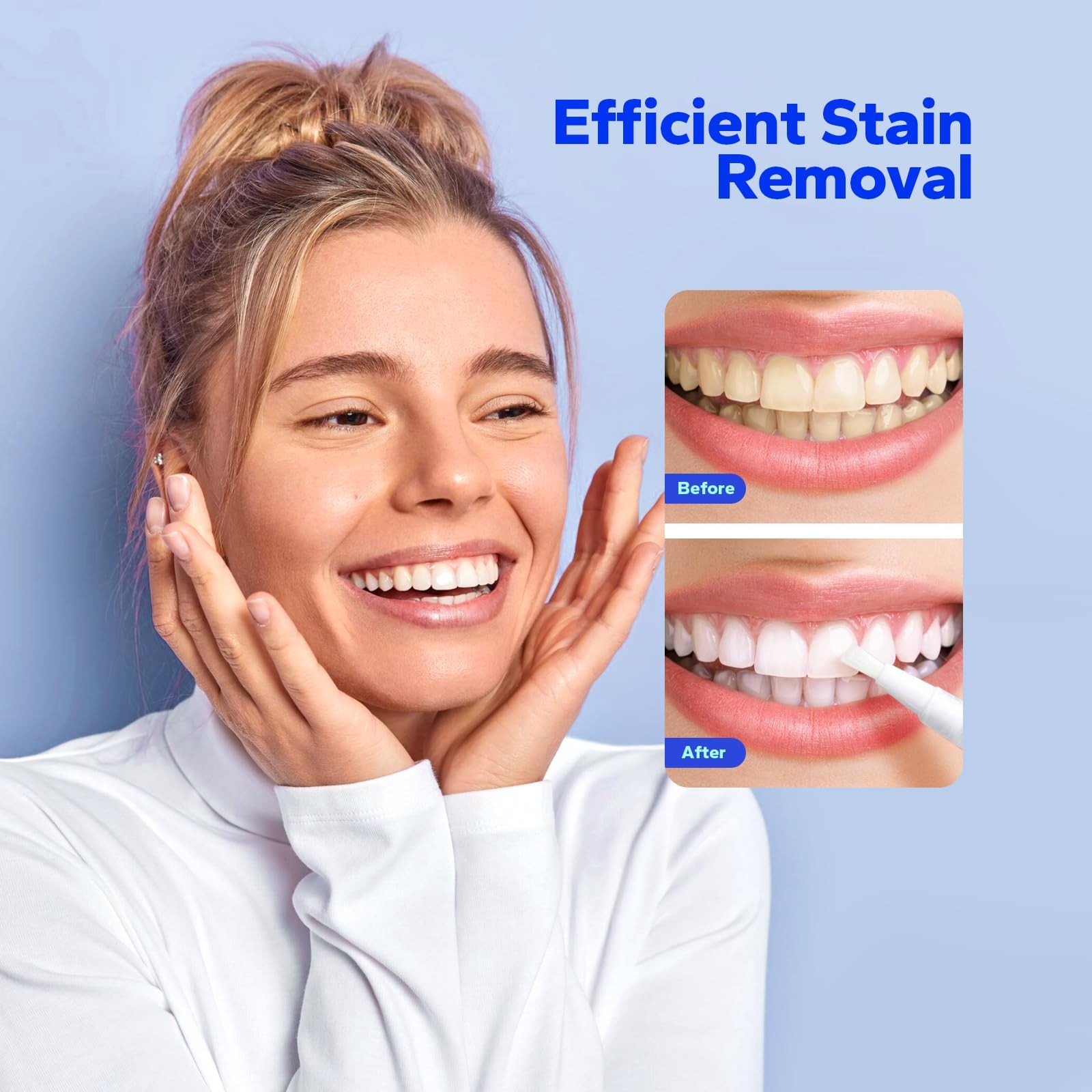 SmileShark Premium Teeth Whitening Pens 0.02 Fl Oz (Pack of 4), Transparent