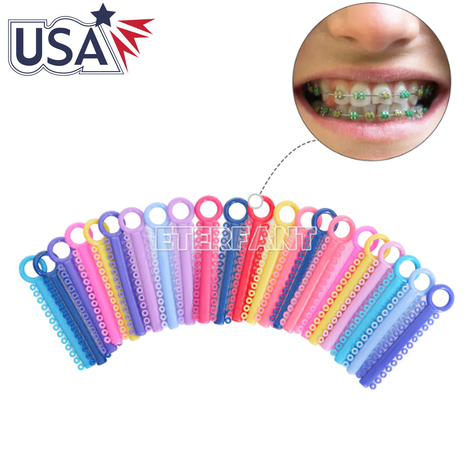 1040pc Orthodontic Ligature Ties Elastic Ligas Ortodoncia Rubber Bands Brackets