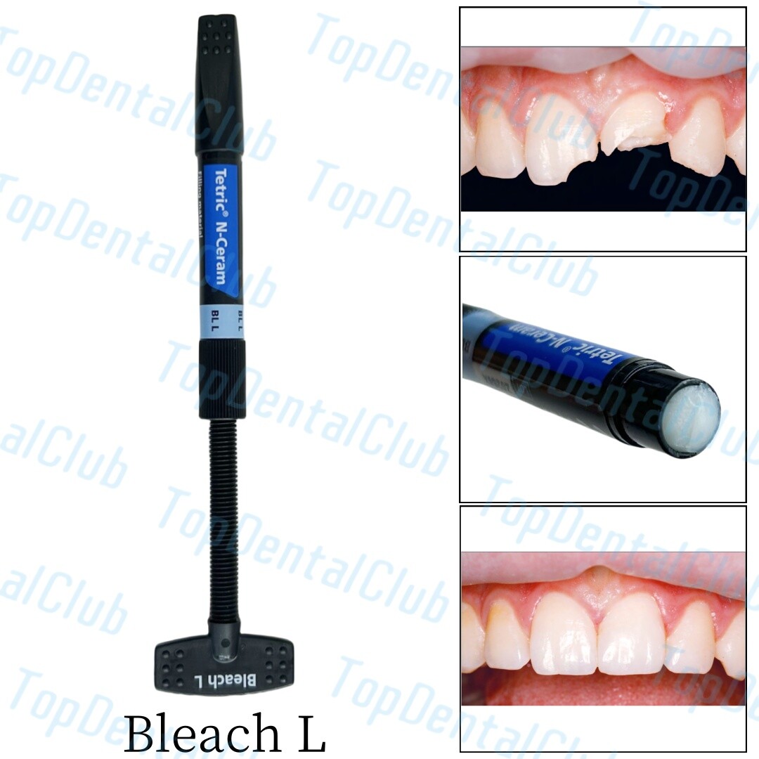 BLL Dental Tetric N-Ceram Composite Resin BL L Bleach L Color Whitening Veneer