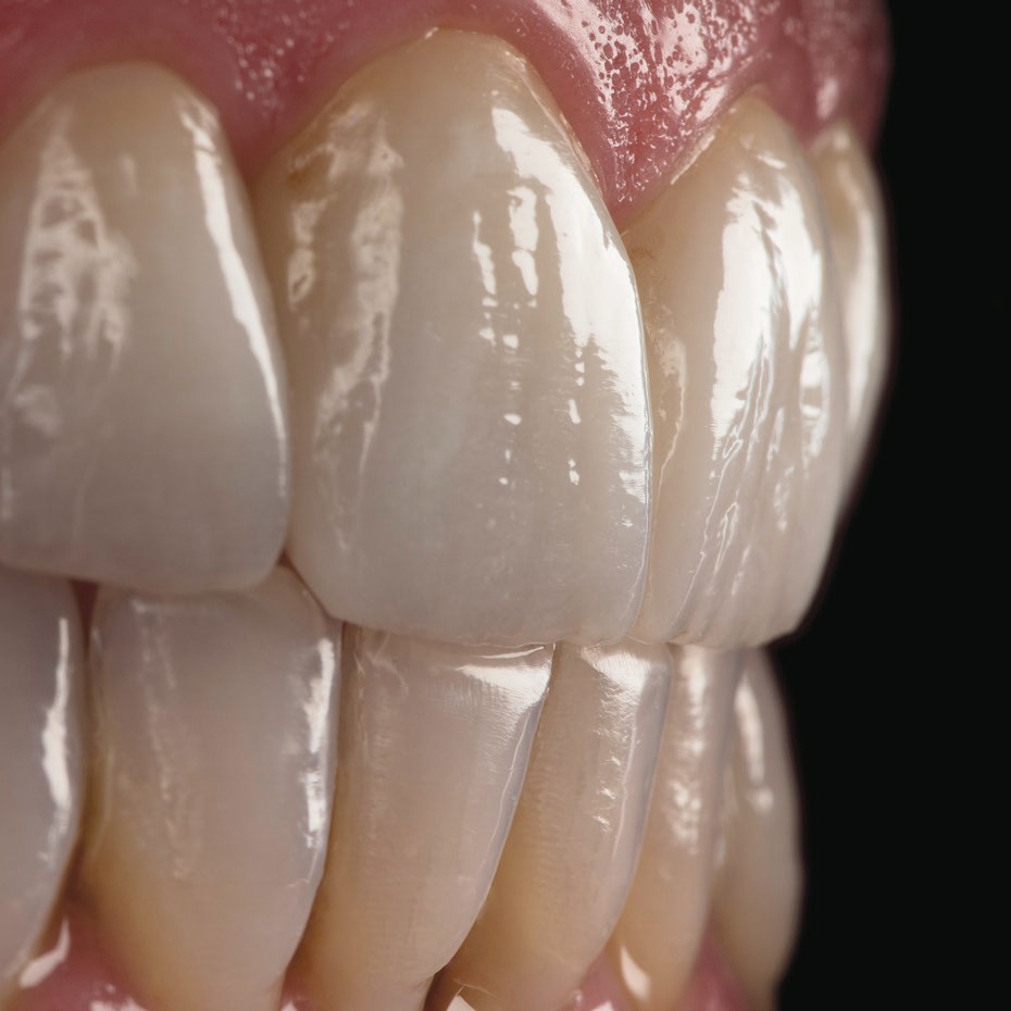 US Dental C14 CAD/CAM Emax Glass Ceramic Block Lithium Disilicate CEREC Block