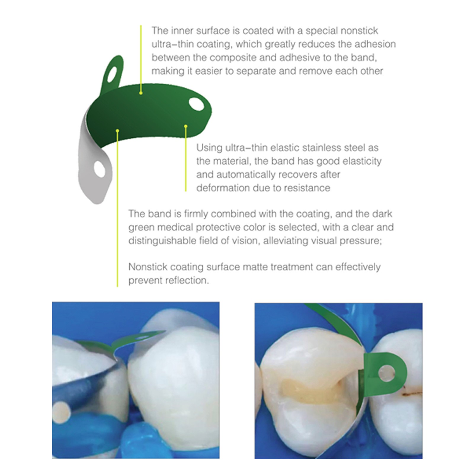 Dental Sectional Matrix Bands M4 1.0 2.0 With Holes 3.5/4.5/5.5/6.5mm Non-Stick