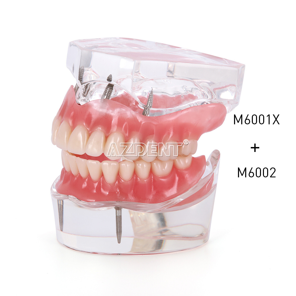 Dental Overdenture Implant Teeth Model Denture with implant Demonstration Clear