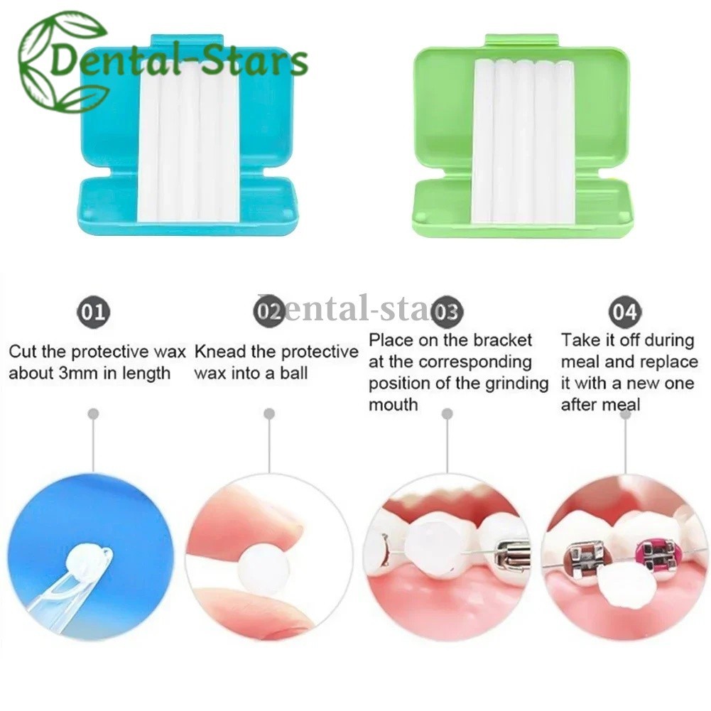 5/100Pcs Dental Orthodontic Ortho Protecter Wax for Braces Relief Gum irritation