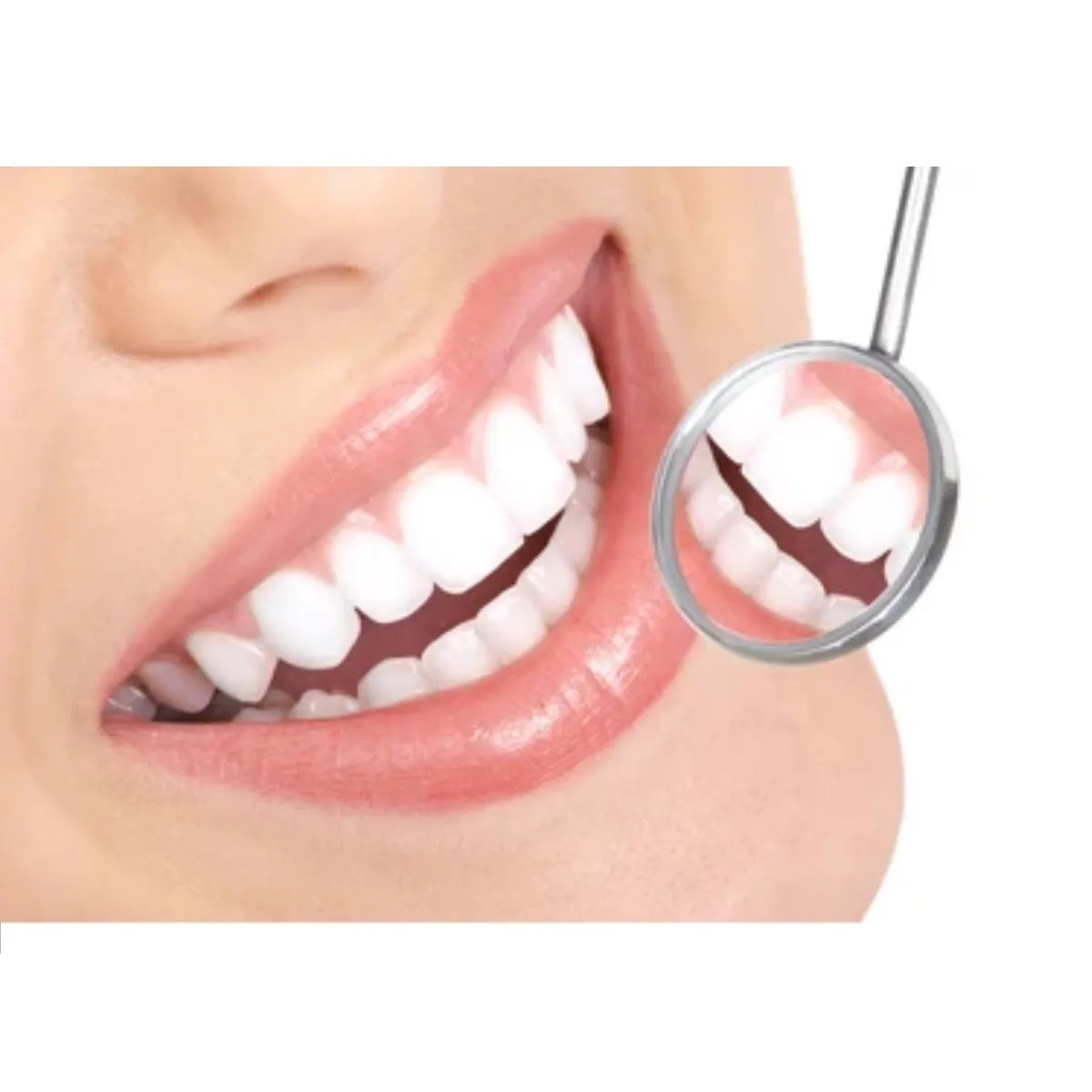 GI Mouth Mirror Tops Plain No. 5 (Pack Of 10)