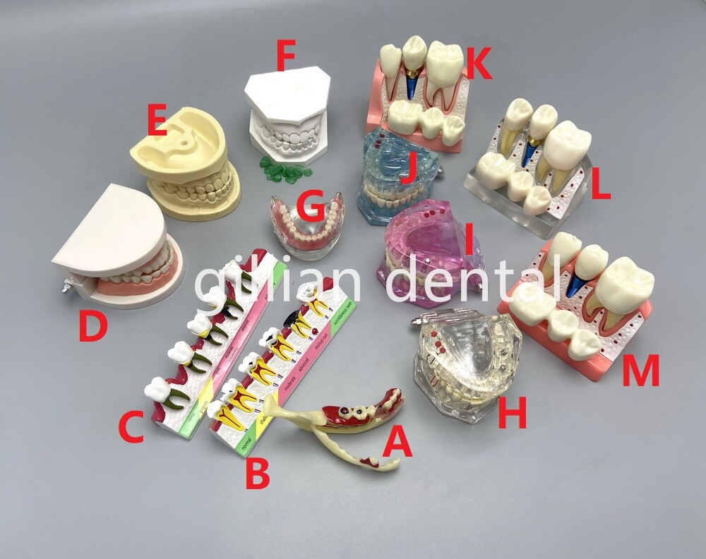 Dental Model Teeth Implant Restoration Bridge Teaching Study Medical Science