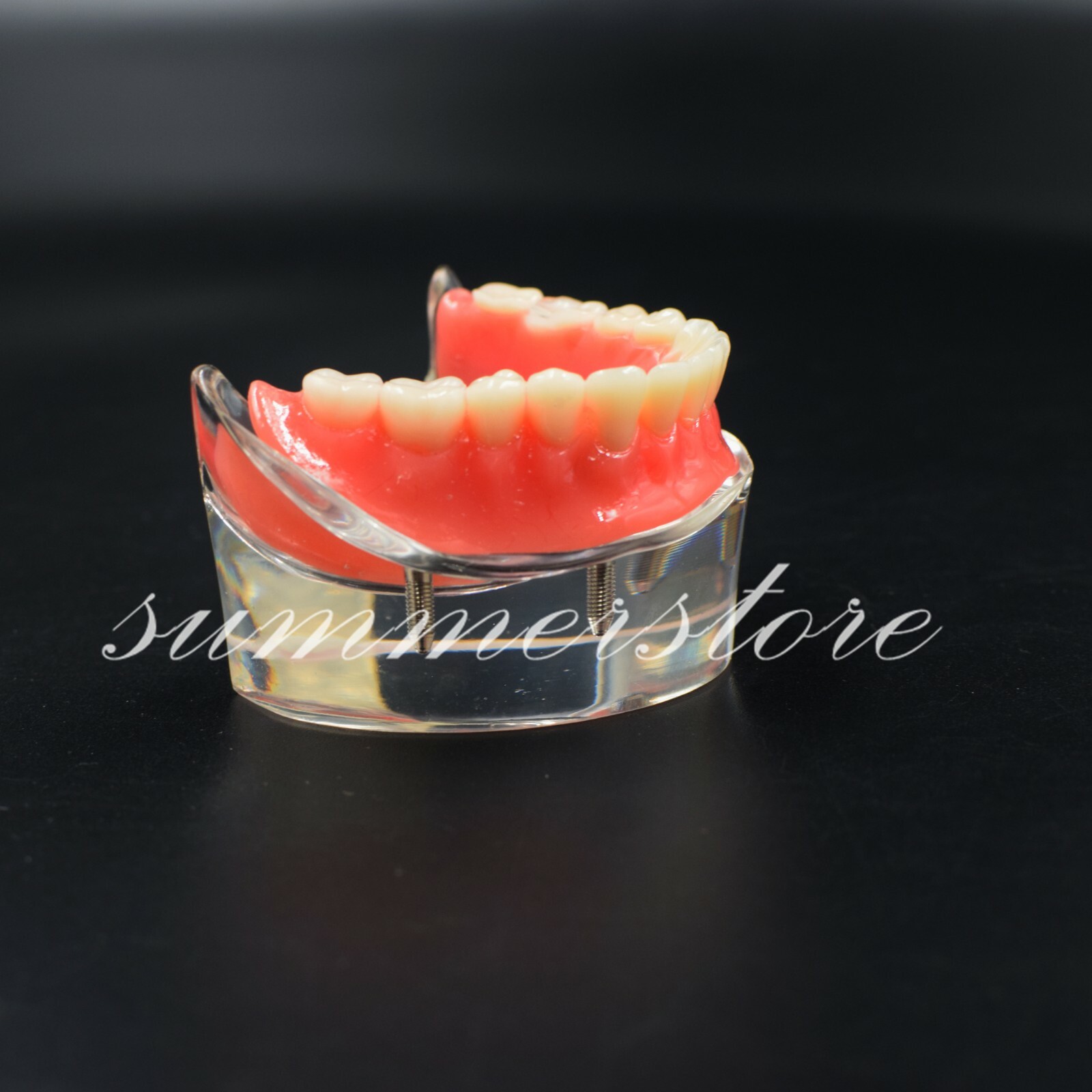 1 Pc Transparent Dental Study Demo 4 Implants Overdenture Inferior Model #6003