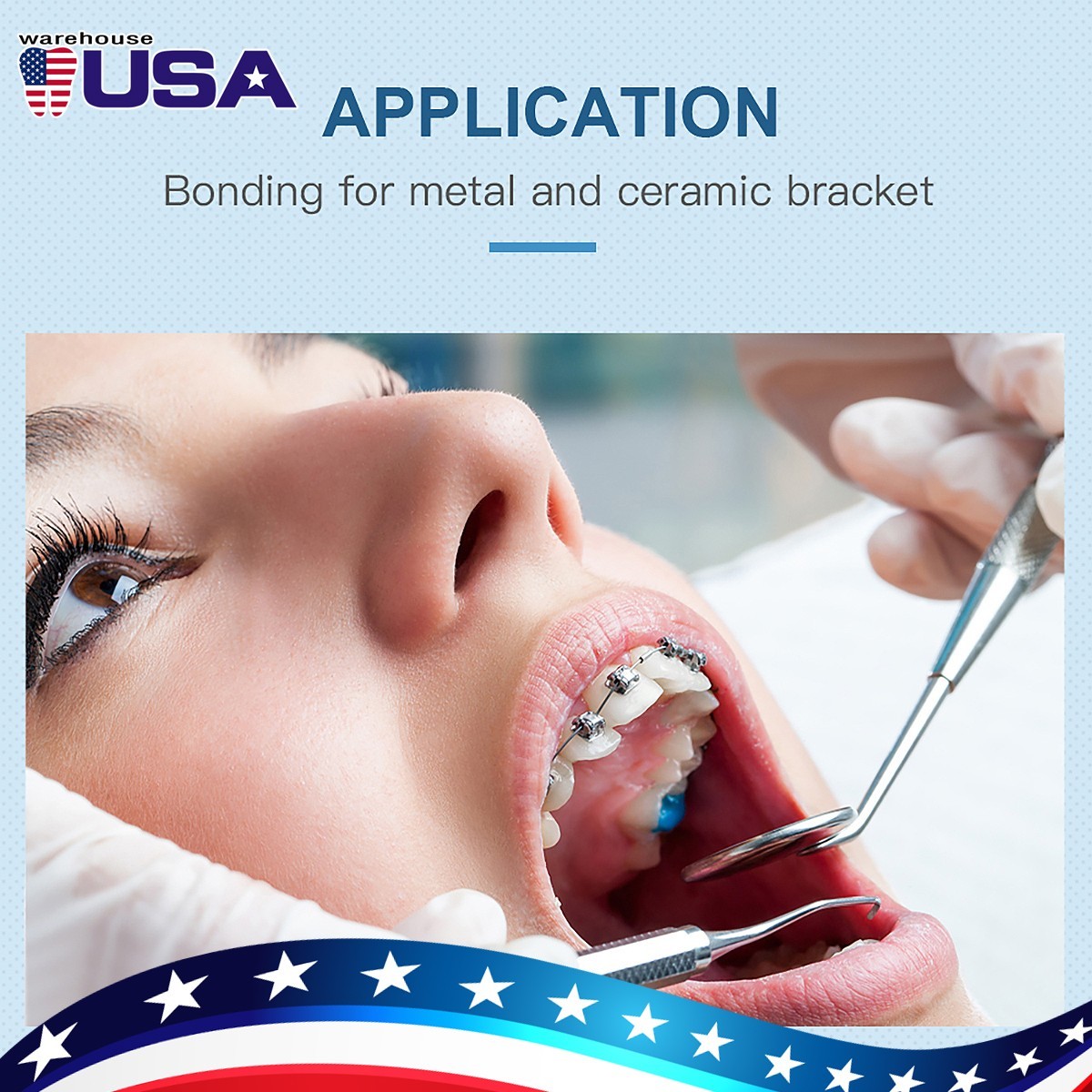 Dental Orthodontic Light Cure Brackets Adhesive Bonding System