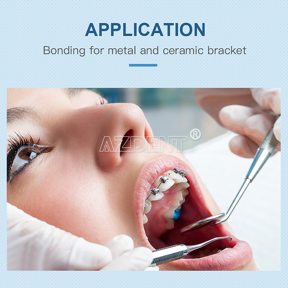 Dental Orthodontic Light Cure Adhesive Bonding Curing Paste Etchant Gel Kit