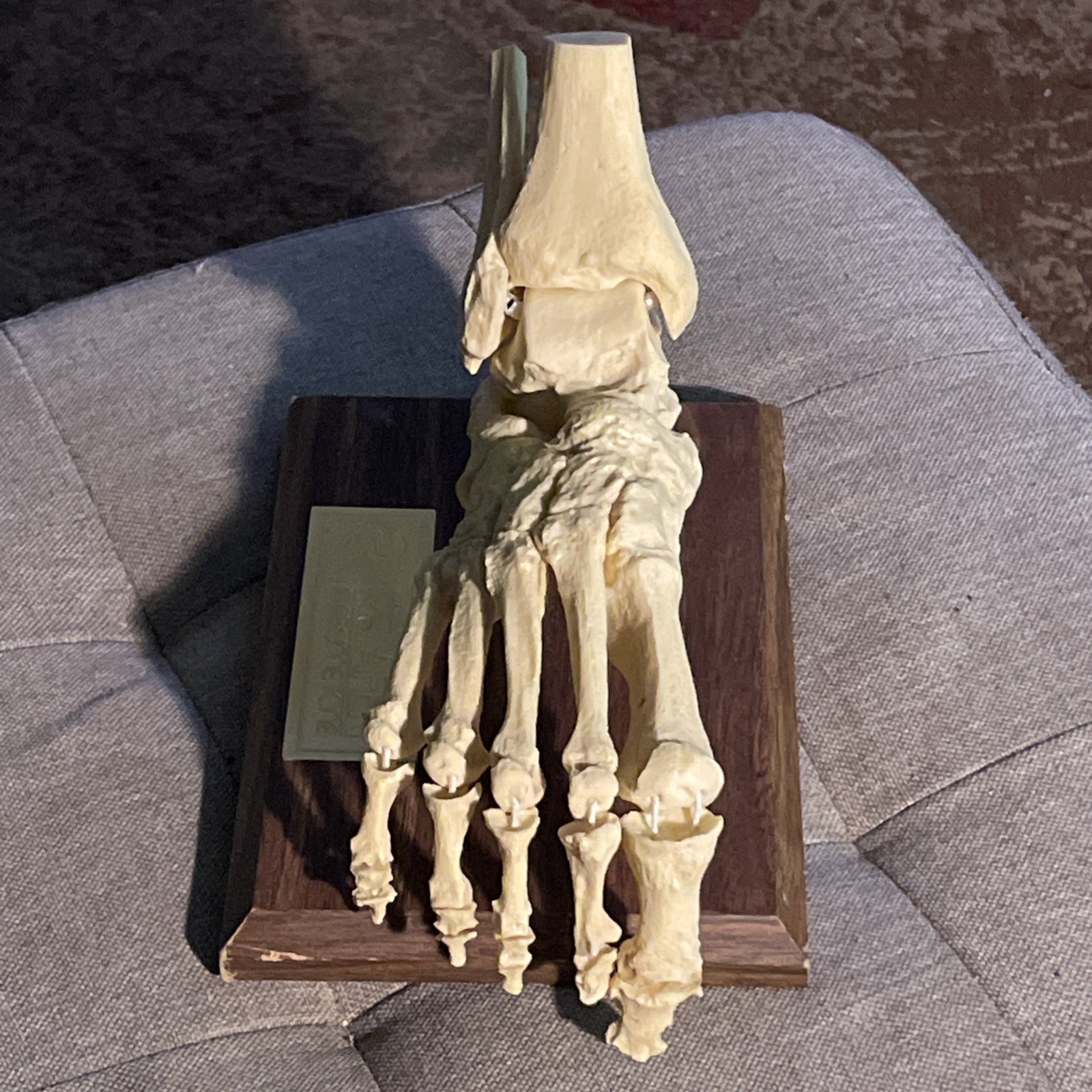 Foot BONES medical anatomical model dissection human anatomy Relafen nabumetone