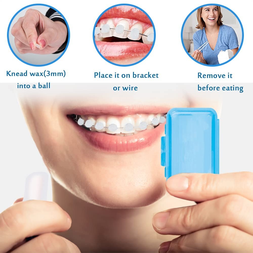 Orthodontic Wax for Braces – 6 Colorful Scents for Ultimate Comfort and Relief