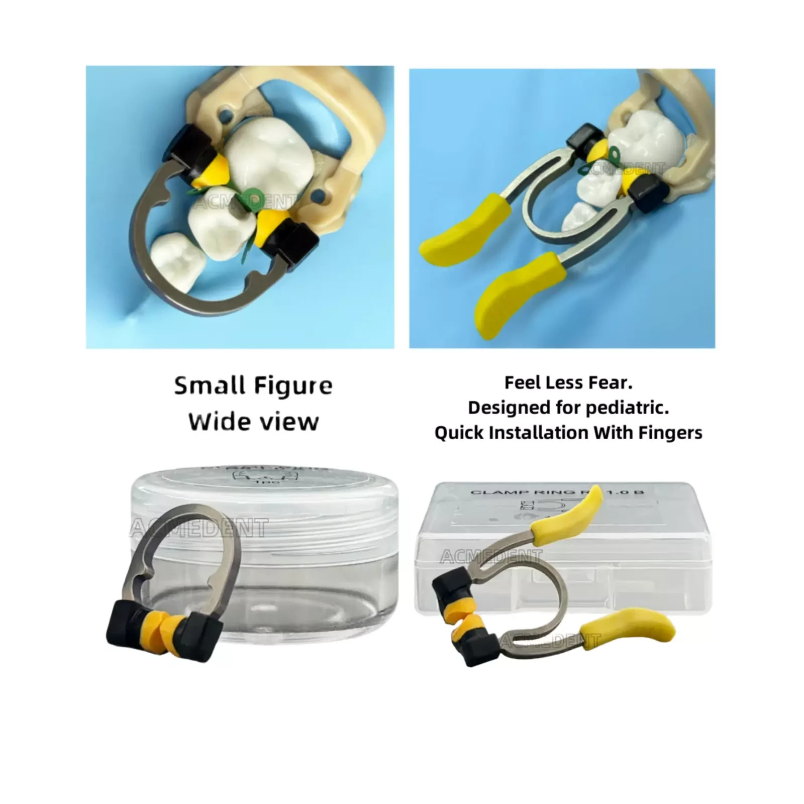 2 Type Dental Matrix System Clamp Ring R8 Niti Nickel Titanium Alloy for Kids