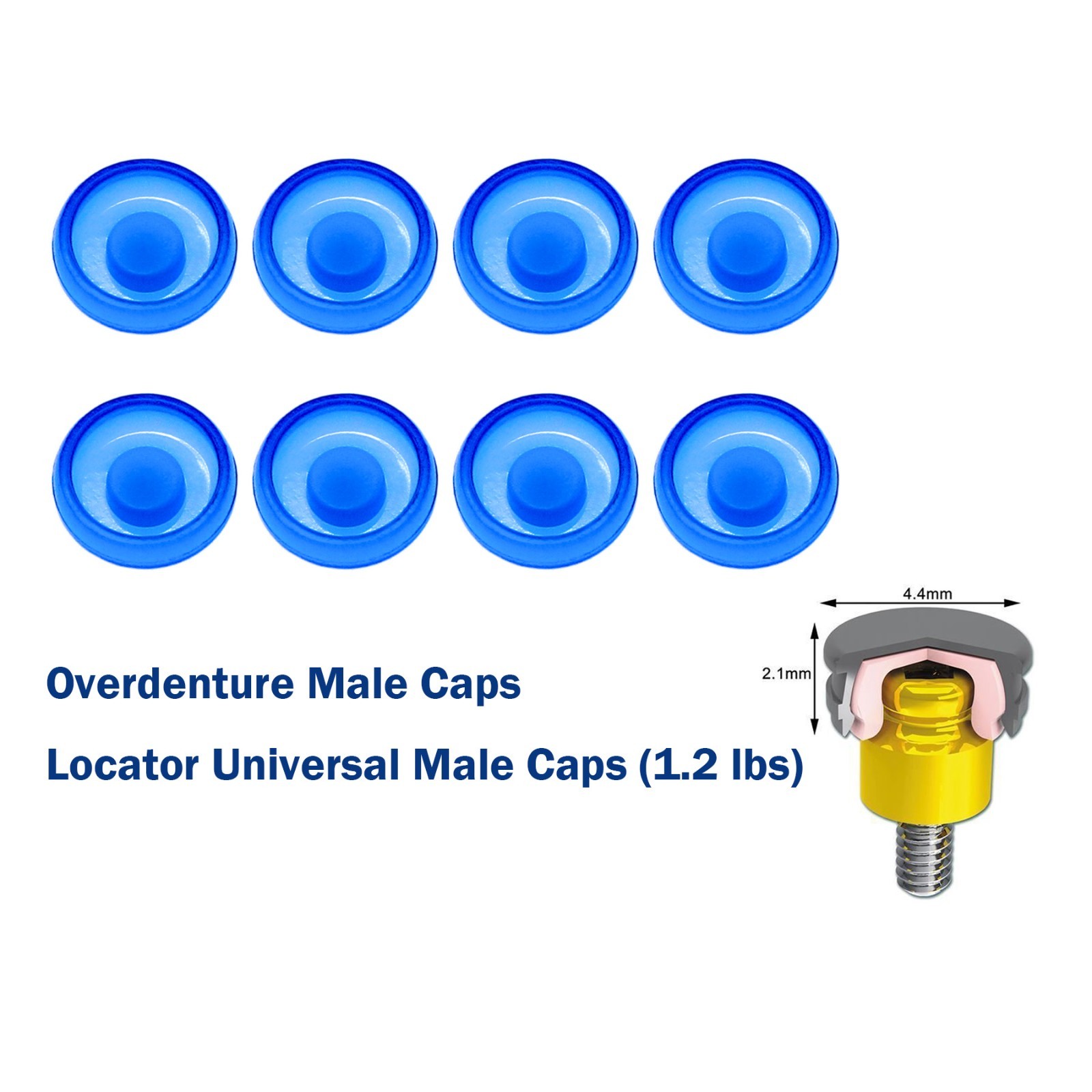 US Dental fit ZEST locator Male Cap Inserts Standard Angle Range 20°-1.2/2.4lbs