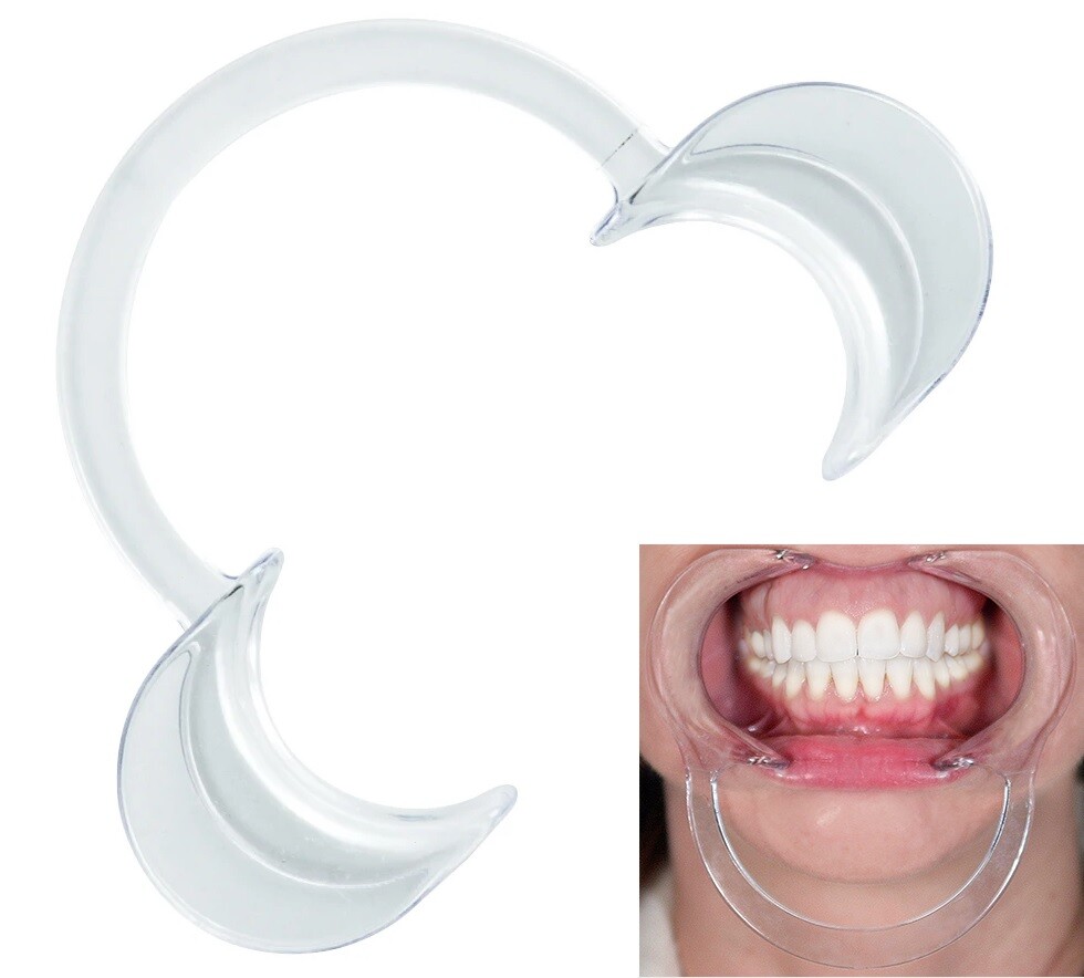 80 Large Teeth Whitening Cheek Retractor, Autoclavable Dental Mouth Opener Game