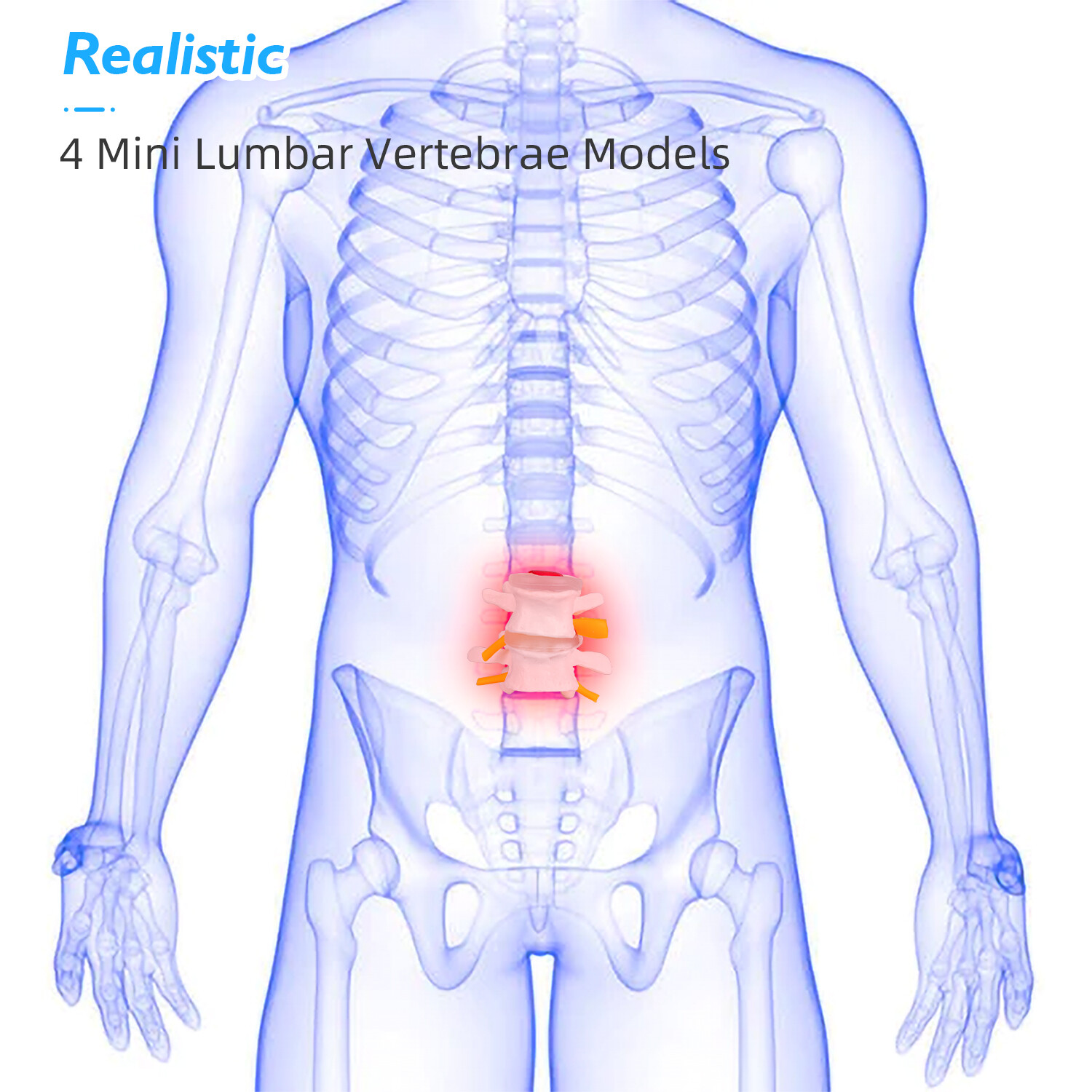 Pathological Human Lumbar Spine Anatomy Model 4-Stage Medical Science Teaching