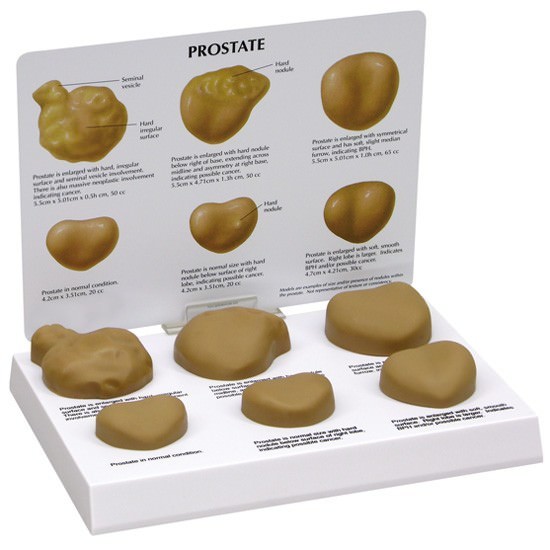 Prostate GPI Anatomical Model Set BPH Card LFA #3000.Make Us an Offer! SEE VIDEO