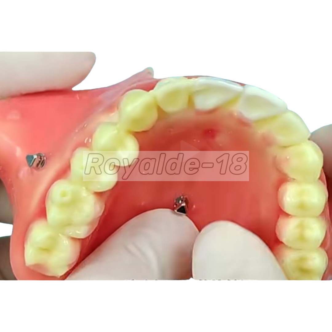 Dental TAS Mini Screw Anchorage Micro Screws Driver Orthodontic Vector Style