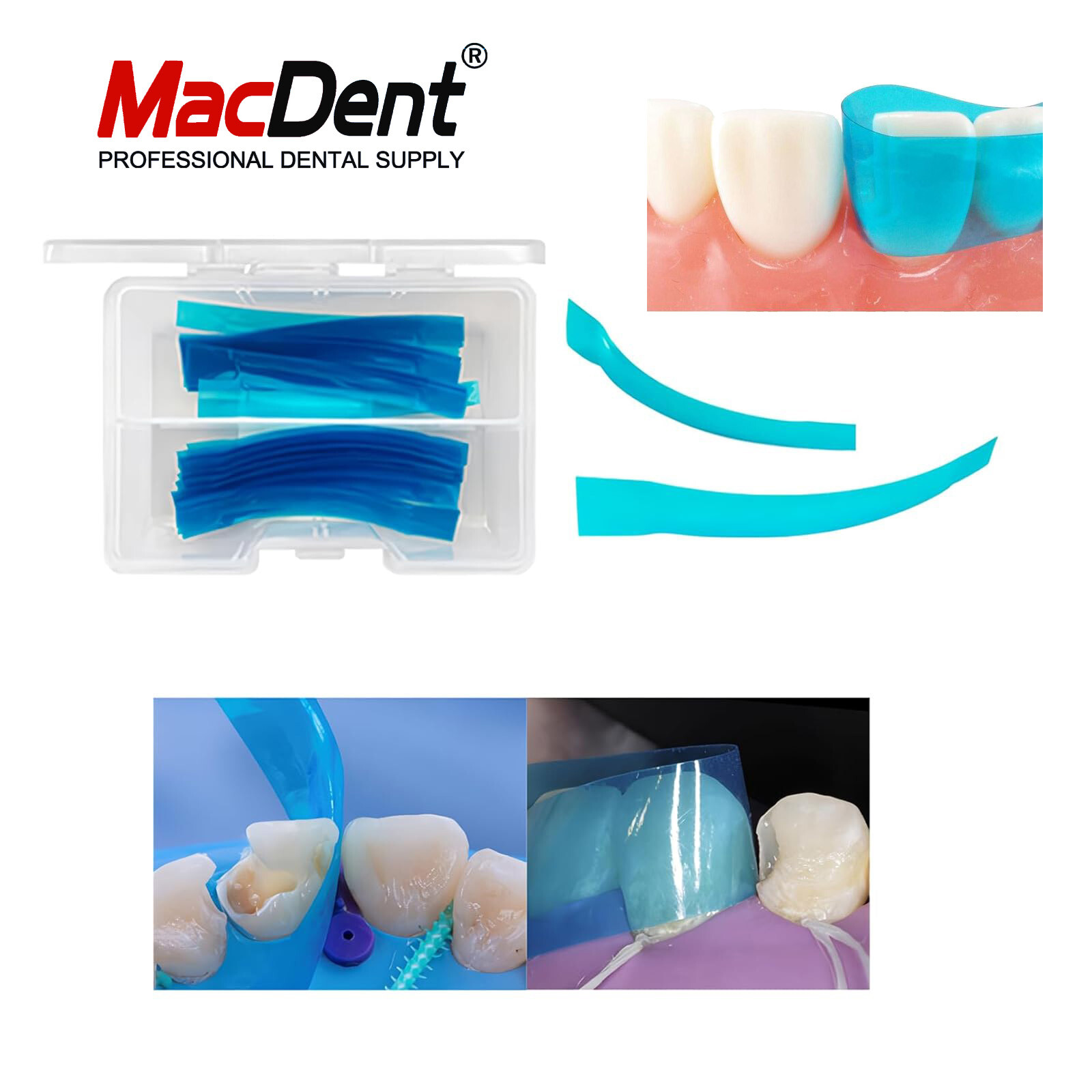 Dental Blue view varistrip Contoured Anterior Matrix Bands Restoration Matrices