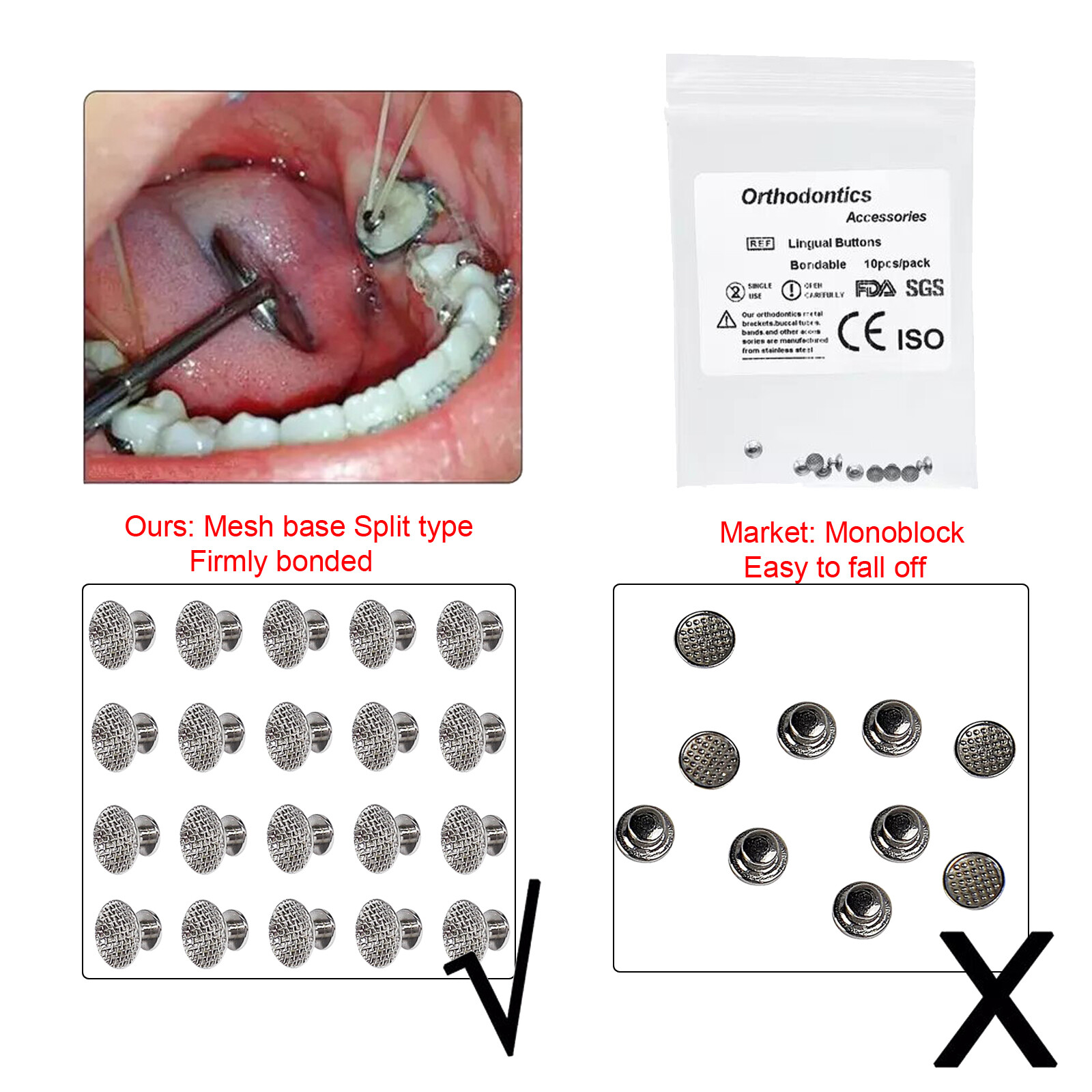 50 Pcs Dental Orthodontic Bondable Metal Lingual Buttons Round Mesh Base Split